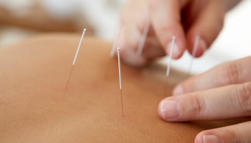 Placebo Acupuncture Needle