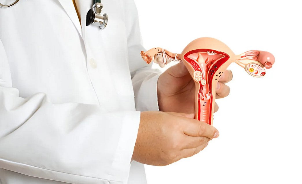 Uterine arteries of infertile women