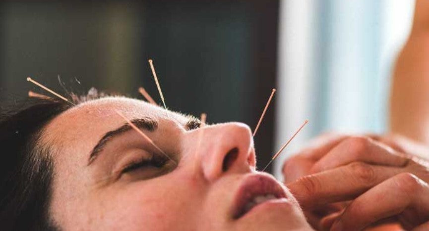 Acupuncture's Therapeutic effect